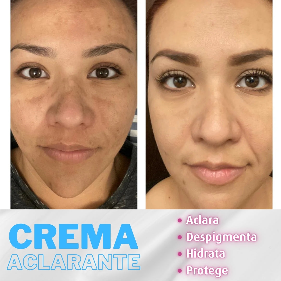 Crema Aclarante 2x1